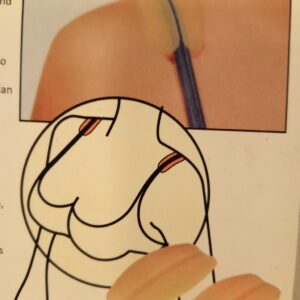 Protegge dalle spalline del reggiseno